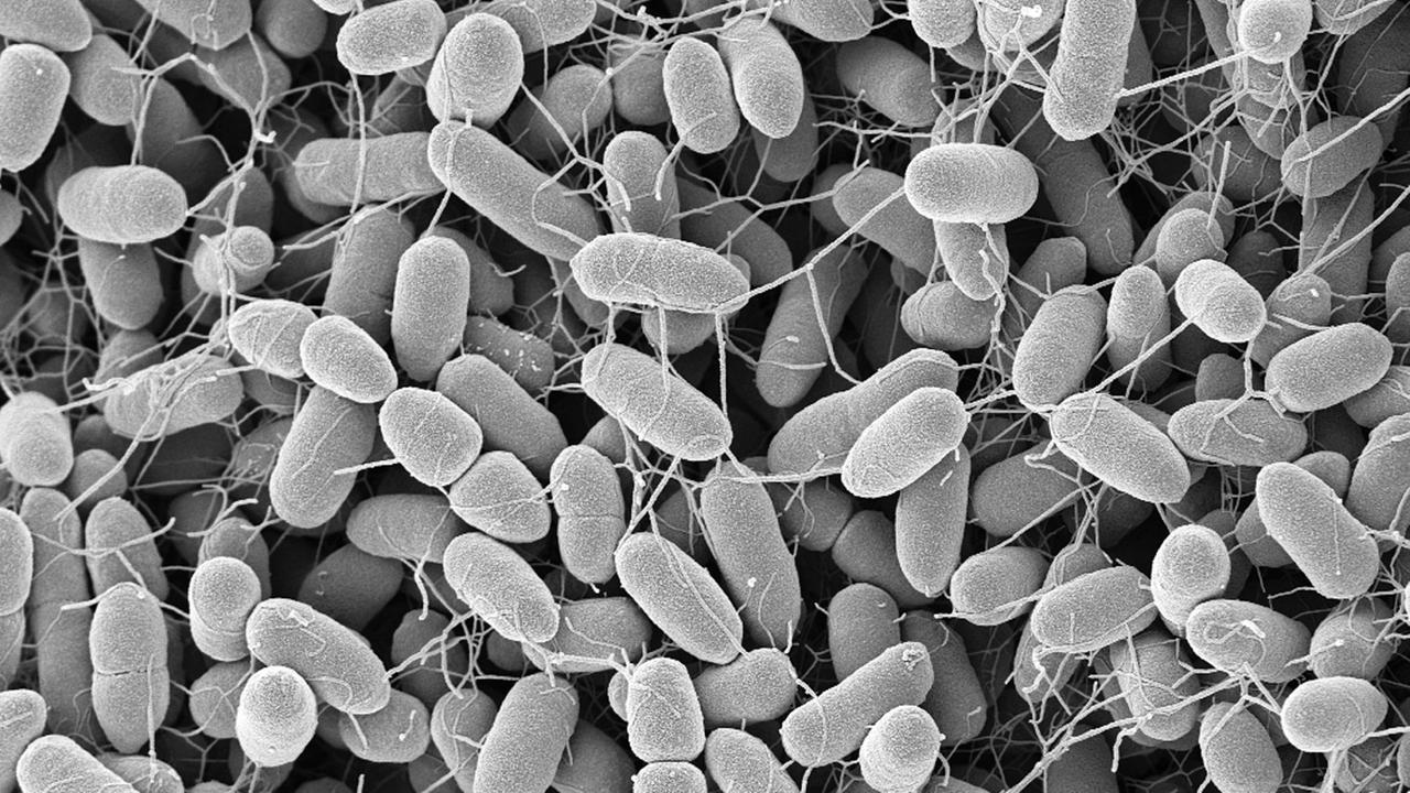 Bakterien Enterobacter cloacae, Primärvergrößerung x 20000, aufgenommen am Robert Koch-Institut Berlin (undatiertes handout).