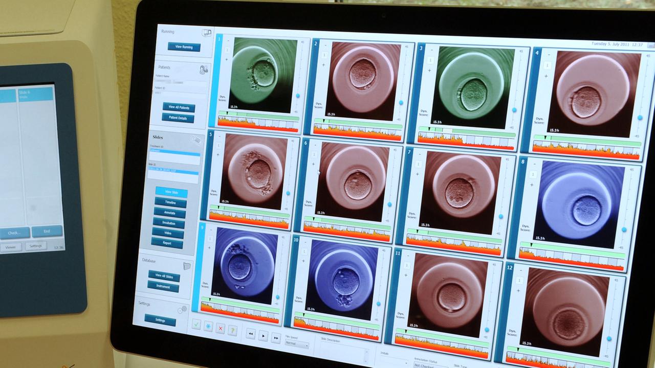 Die Befruchtung einer Eizelle in einem Brutschrank wird in einer Kinderwunschklinik mit integriertem Mikroskop und Kamera (EmbryoScope) in mehreren Stunden aufgenommen. Die Befruchtung einer Eizelle in einem Brutschrank wird in einer Kinderwunschklinik mit integriertem Mikroskop und Kamera (EmbryoScope) in mehreren Stunden aufgenommen.