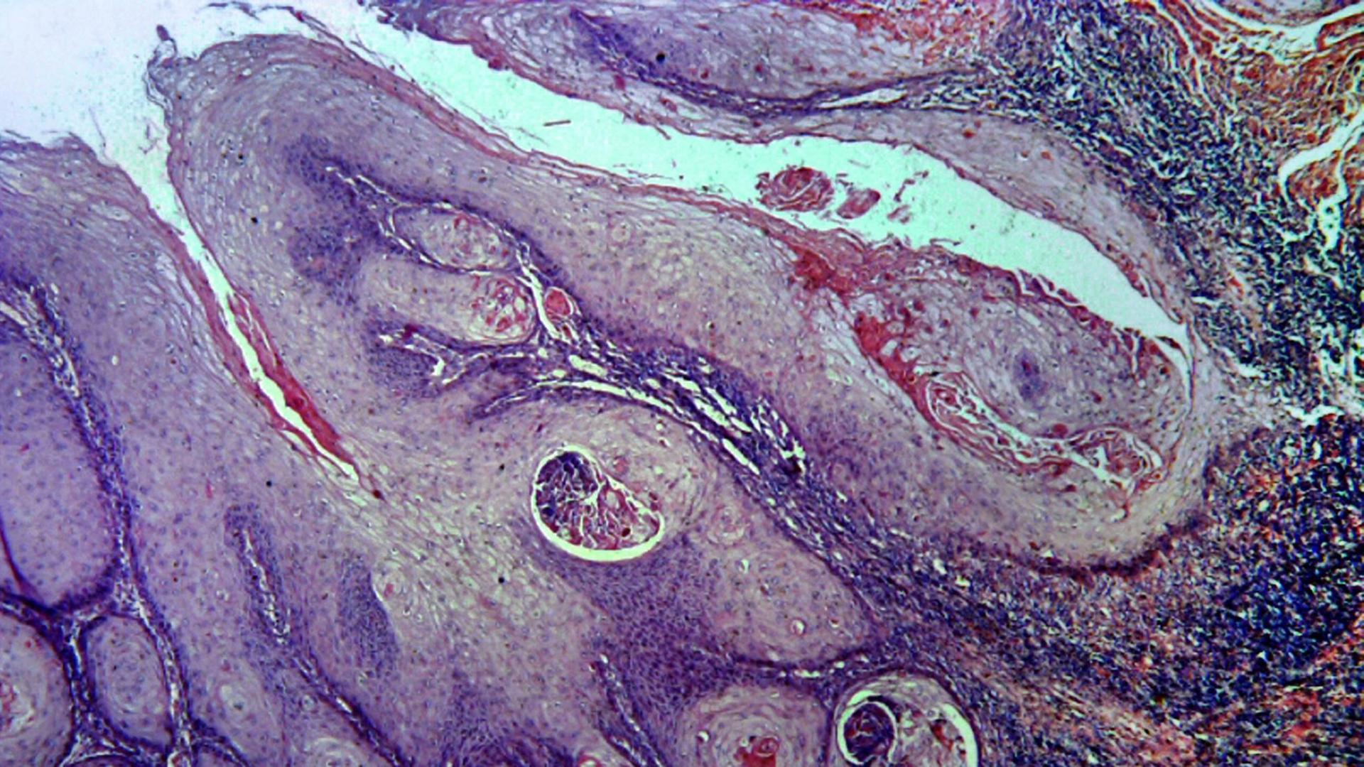 Violett-rötliches, schlierenartig angeordnetes Zellmaterial in einer mikroskopischen Ansicht, die den Eindruck von abstrakter Kunst entstehen lässt. Violett-rötliches, schlierenartig angeordnetes Zellmaterial in einer mikroskopischen Ansicht, die den Eindruck von abstrakter Kunst entstehen lässt.