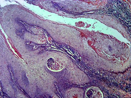 Violett-rötliches, schlierenartig angeordnetes Zellmaterial in einer mikroskopischen Ansicht, die den Eindruck von abstrakter Kunst entstehen lässt.