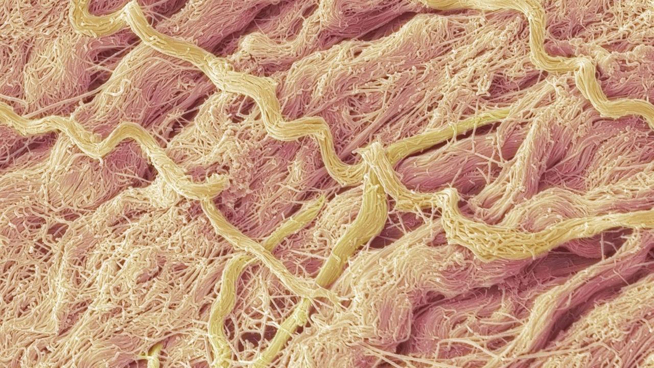 Interstitium-Aufnahme mit elektronischen Mikrograf Interstitium-Aufnahme mit elektronischen Mikrograf