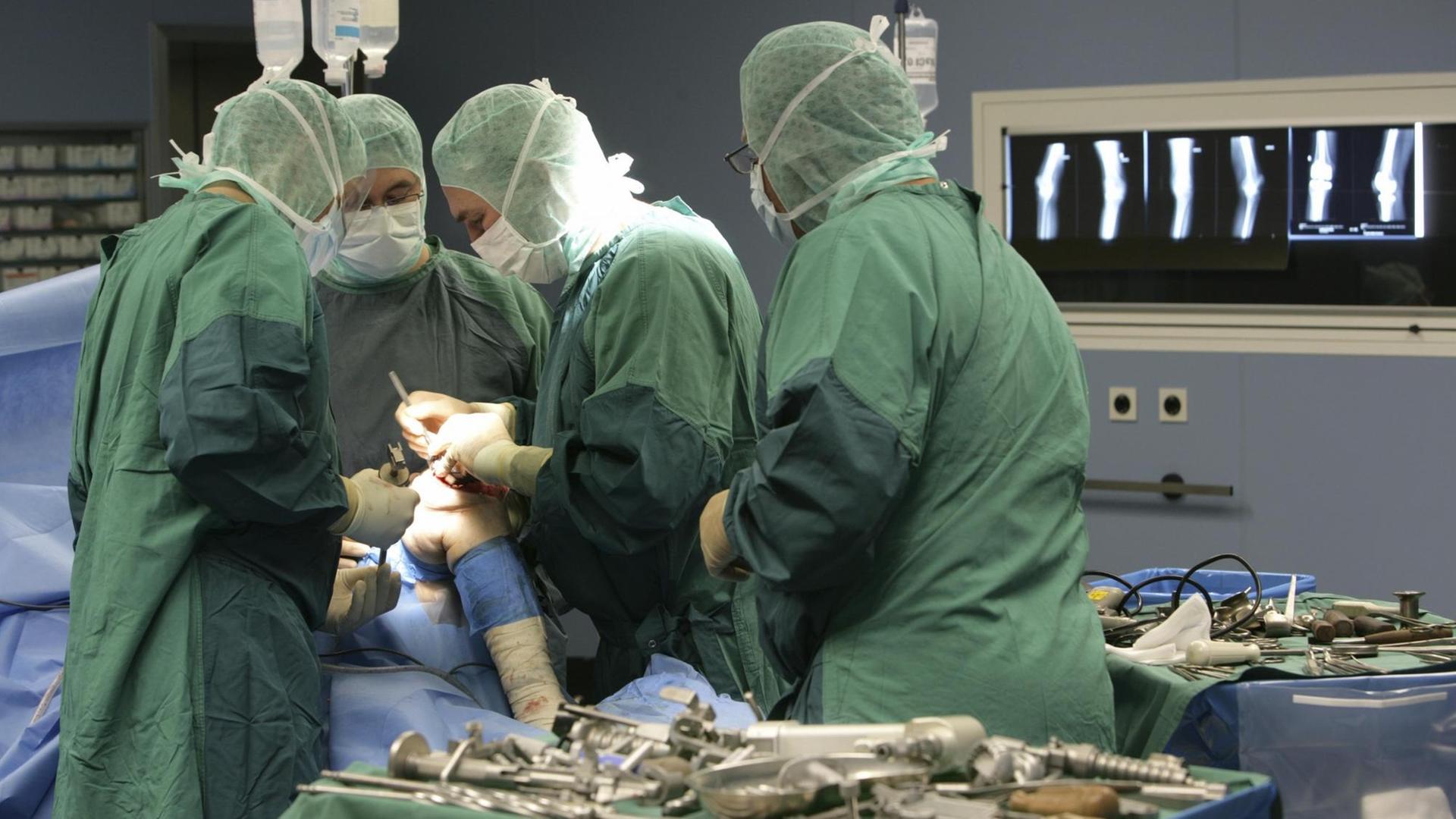Ärzte setzen einem Patienten ein künstliches Kniegelenk ein. Ärzte setzen einem Patienten ein künstliches Kniegelenk ein.