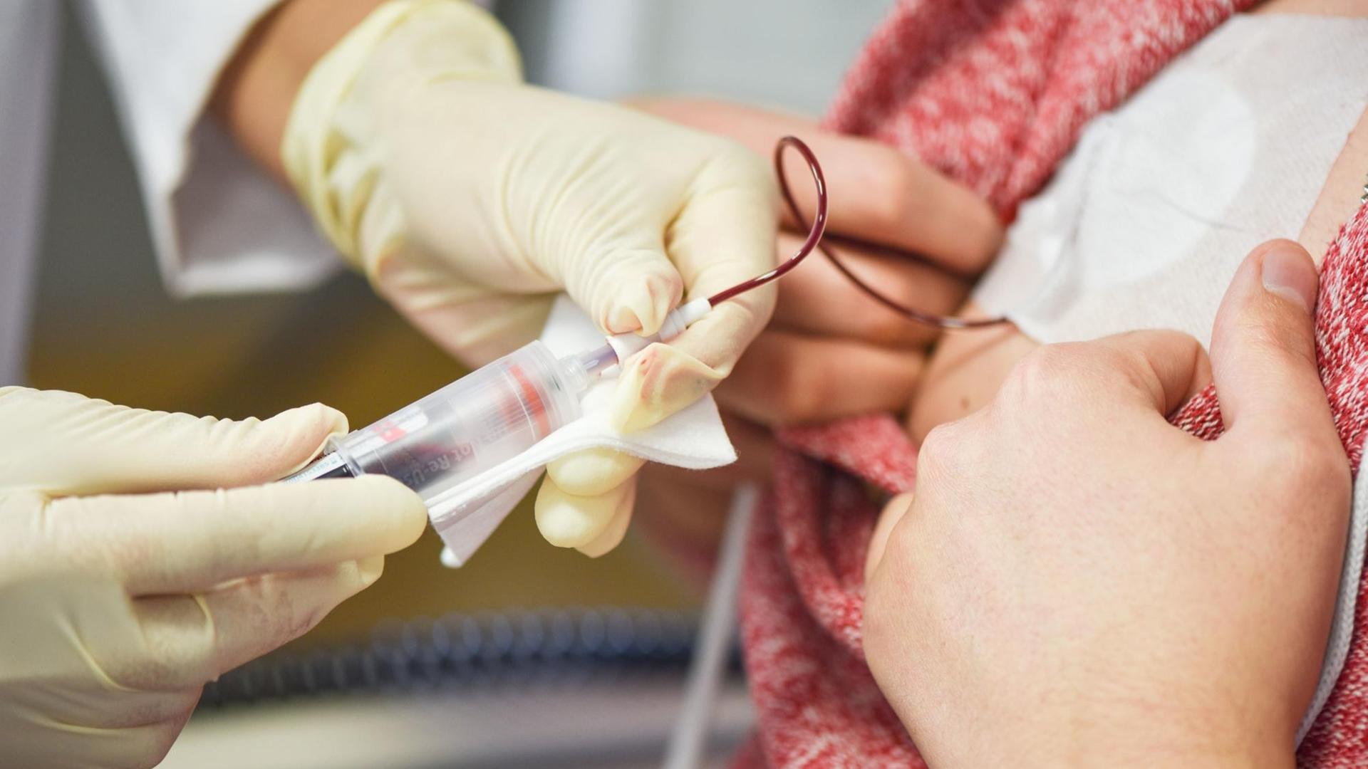 Dem Patienten Georgios Kessesidis wird am 21.01.2015 in Heidelberg (Baden-Württemberg) im Nationalen Centrum für Tumorerkrankungen (NCT) eine Blutprobe entnommen. Dem Patienten Georgios Kessesidis wird am 21.01.2015 in Heidelberg (Baden-Württemberg) im Nationalen Centrum für Tumorerkrankungen (NCT) eine Blutprobe entnommen.