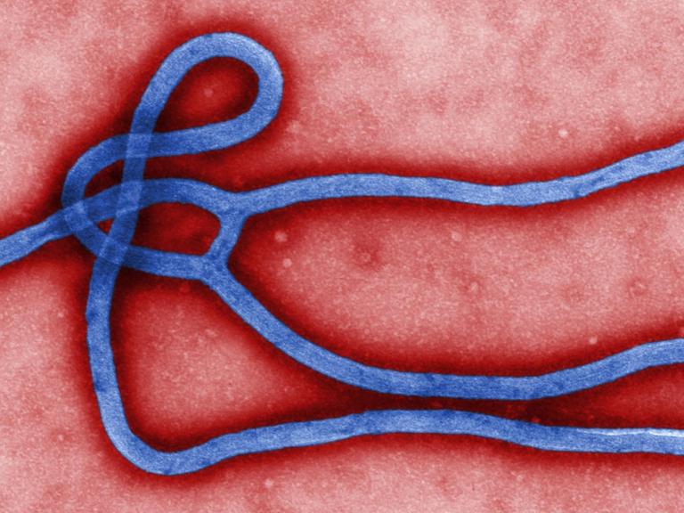 Farbige Elektronen-mikroskopische Darstellung der ultrastrukturellen Morphologie eines Ebola Virus Virion.