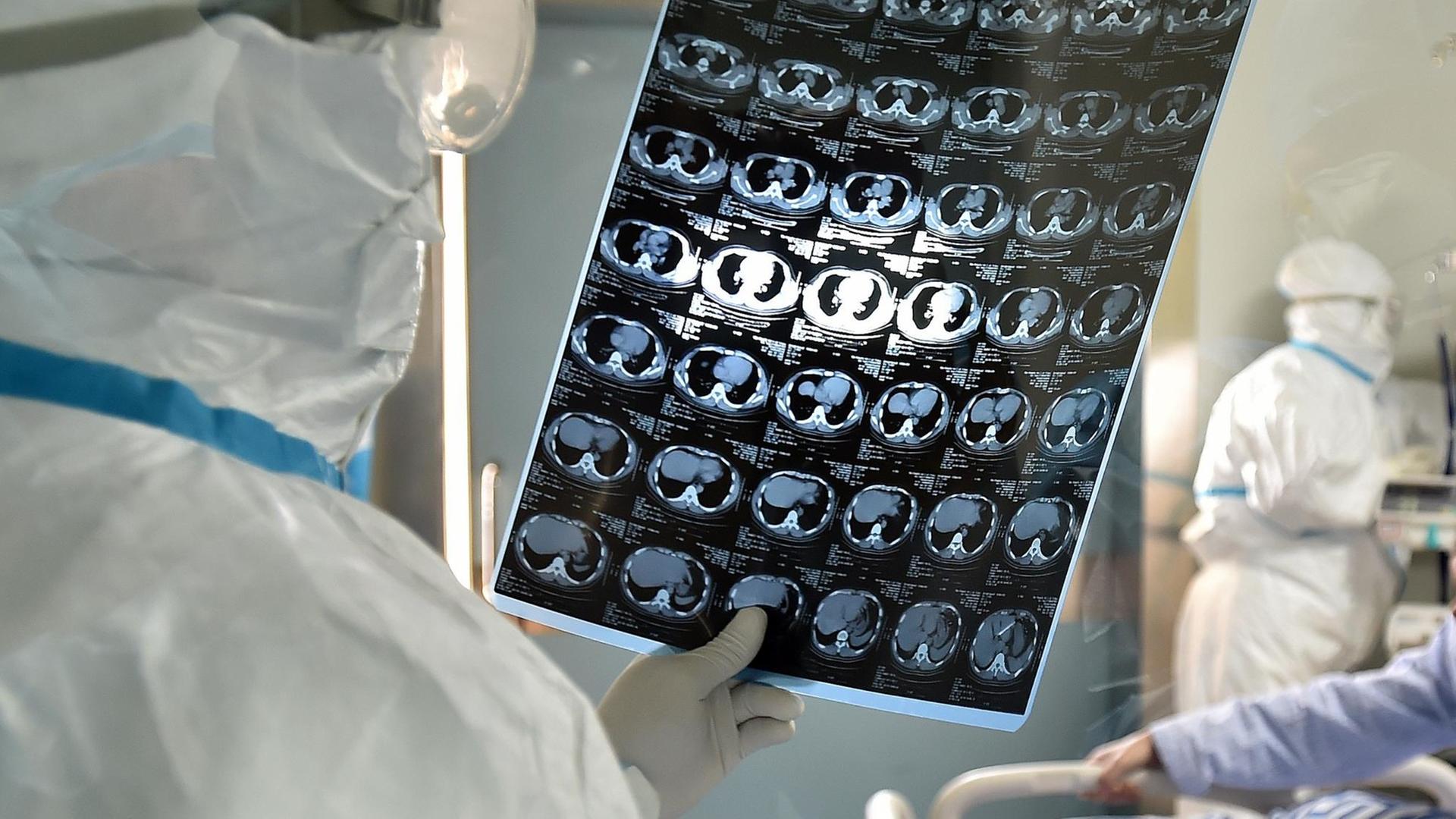 Ein Arzt begutachtet CT-Bilder eines Patienten mit einer durch den Coronavirus ausgelösten Lungenentzündung.