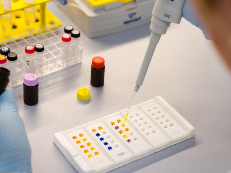 Eine Labormitarbeiterin untersucht in Dassow (Mecklenburg-Vorpommern) bei der Firma Euroimmun bei einem Immunfluorenztest eine Probe mit Antikörpern. Für den Nachweis des Zika-Virus setzt Brasilien Diagnosetechnik ein, die in Nordwestmecklenburg produziert wird.