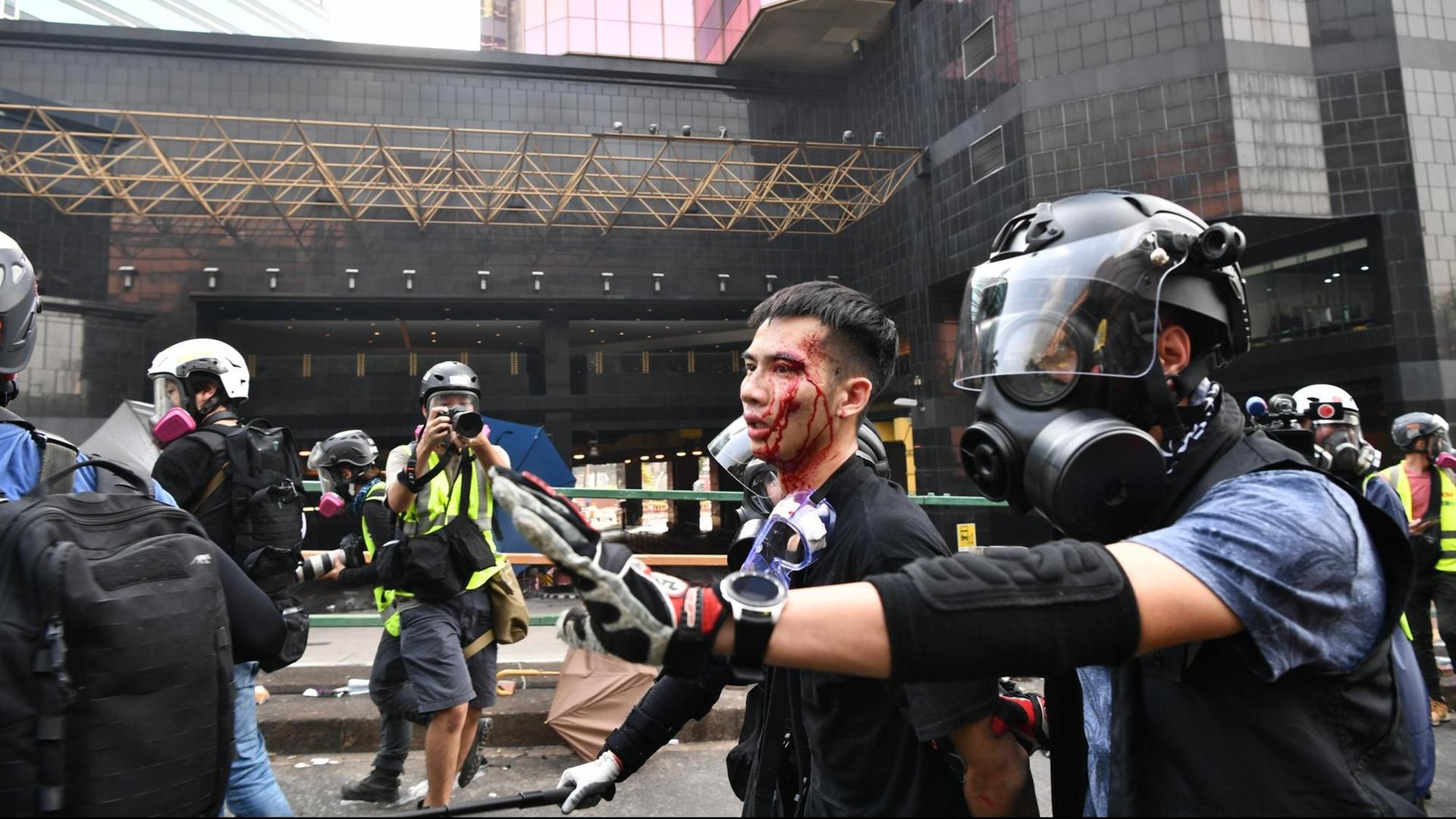 Ein im Demonstrant wird in Hongkong von Polizisten abgeführt. Er ist am Kopf verletzt, Blut rinnt über das Gesicht. Die Polizisten tragen Helme und Atemschutzmasken. Ein Fotograf fotografiert die Szene.