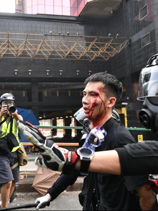 Ein im Demonstrant wird in Hongkong von Polizisten abgeführt. Er ist am Kopf verletzt, Blut rinnt über das Gesicht. Die Polizisten tragen Helme und Atemschutzmasken. Ein Fotograf fotografiert die Szene.