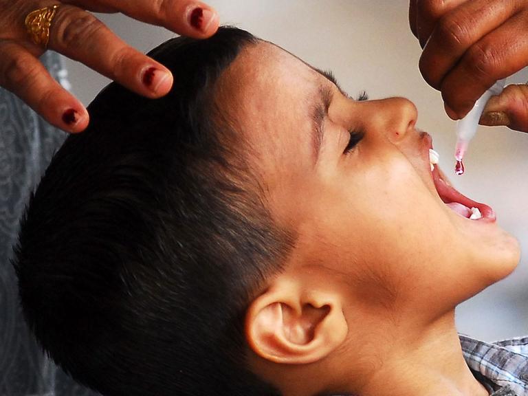 Ein Junge erhält die Kinderlähmung-Schluckimpfung und sperrt den Mund auf.