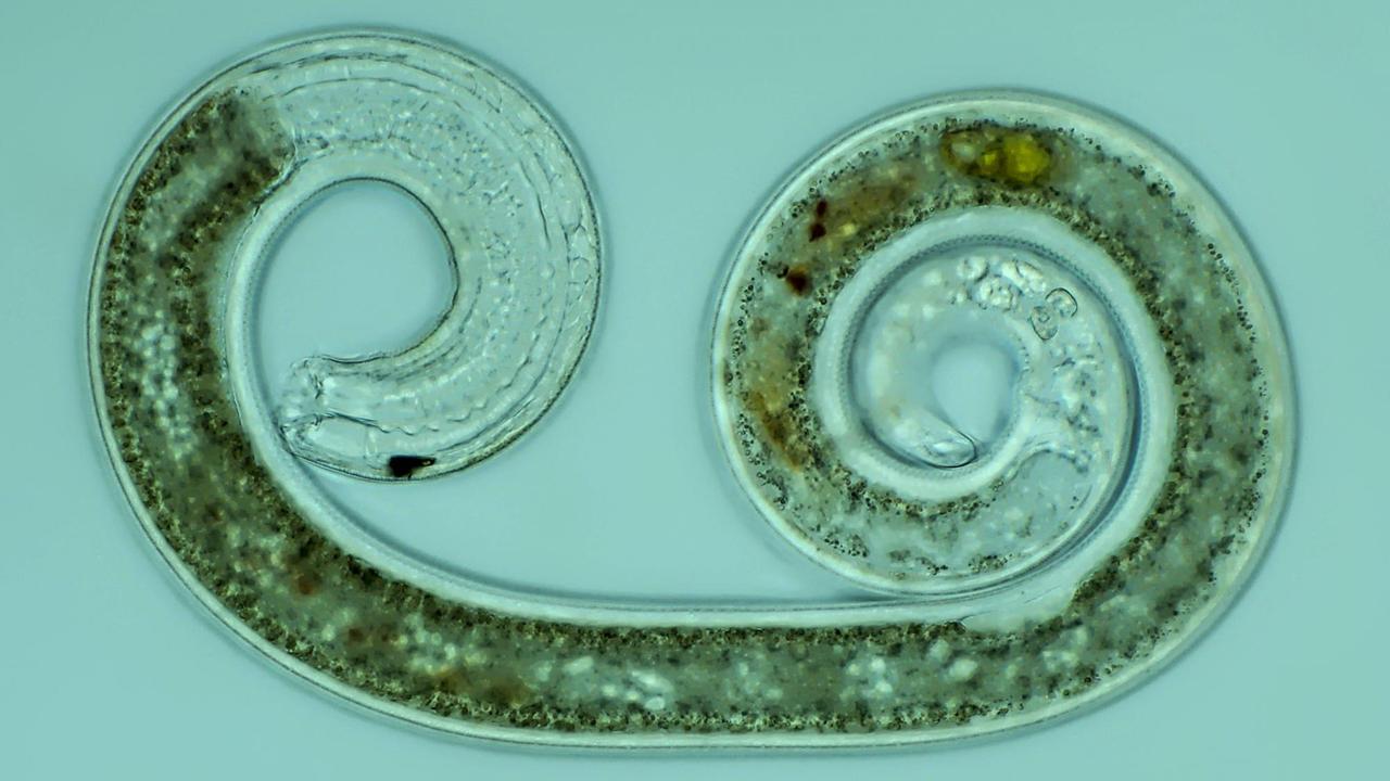 Fadenwurm, Nematode (Nematoda), eingerollt Fadenwurm, Nematode (Nematoda), eingerollt