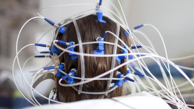 Ein Hinterkopf, an dem etwa ein Dutzend Elektroden zum Zweckke der Hirnstrommessung angebracht sind