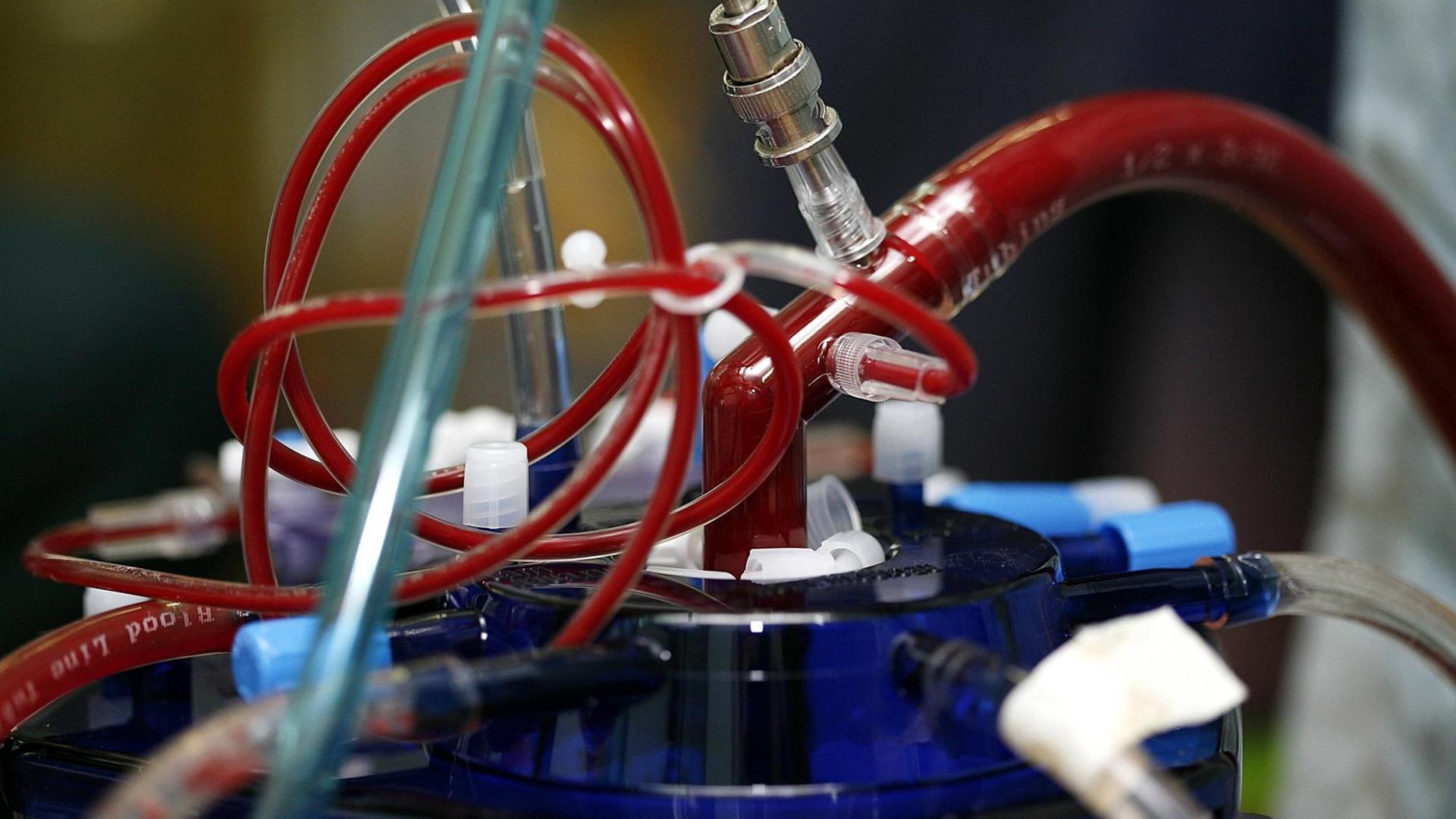 Die Nahaufnahme einer Herz-Lungen-Maschine zeigt mehrere blutgefüllte Schläuche, die zu und von einem metallene Zylinder führe Nahaufnahme eines modernen kardiopulmonalen Bypass- vulgo Herz-Lungen-Maschine Die Nahaufnahme einer Herz-Lungen-Maschine zeigt mehrere blutgefüllte Schläuche, die zu und von einem metallene Zylinder führe Nahaufnahme eines modernen kardiopulmonalen Bypass- vulgo Herz-Lungen-Maschine