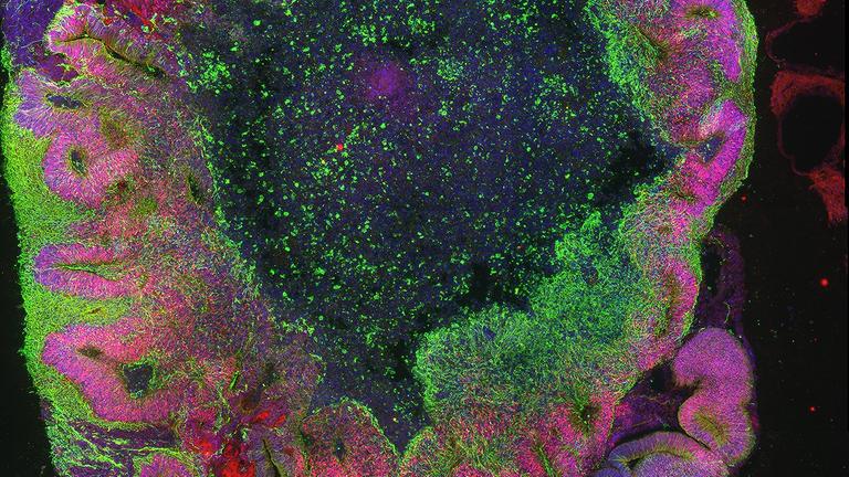Ein Gehirn-Organoid nach 35 Tagen Ein Gehirn-Organoid nach 35 Tagen
