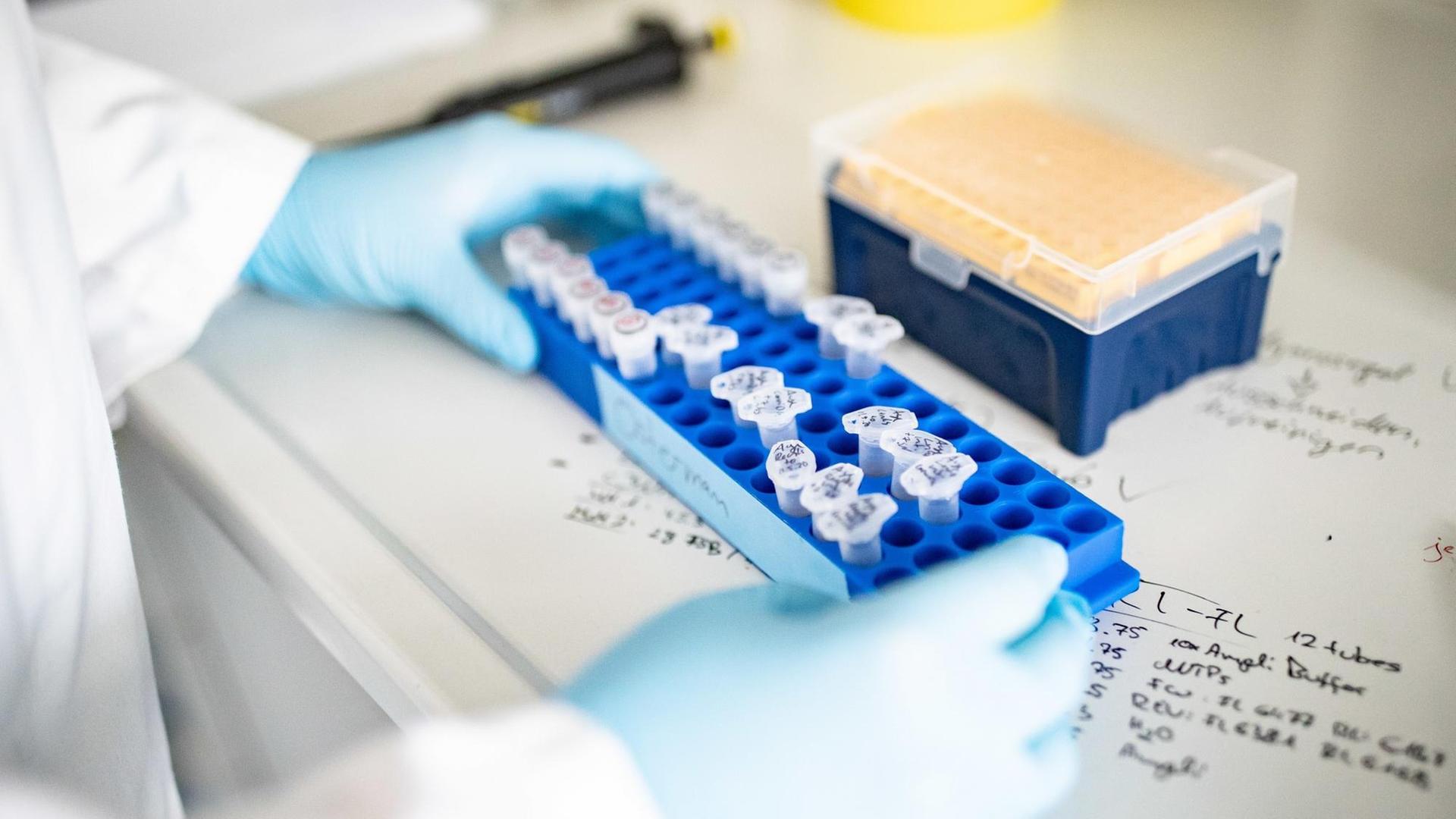 Ein Doktorand der Heinrich-Heine-Universität Düsseldorf arbeitet an Proben für die Coronavirus-Forschung. Die Forschungsprojekte umfassen Immunität nach ausgeheilter Infektion und Forschungsdaten zur Wirksamkeit und Bedeutung von Remdesivir in der klinischen Anwendung. Ein Doktorand der Heinrich-Heine-Universität Düsseldorf arbeitet an Proben für die Coronavirus-Forschung. Die Forschungsprojekte umfassen Immunität nach ausgeheilter Infektion und Forschungsdaten zur Wirksamkeit und Bedeutung von Remdesivir in der klinischen Anwendung.