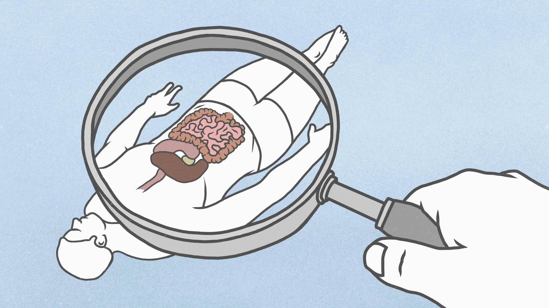 Illustration. Eine Hand hält eine Lupe hinter der ein Mensch liegt dessen Organe zu sehen sind. Illustration. Eine Hand hält eine Lupe hinter der ein Mensch liegt dessen Organe zu sehen sind.