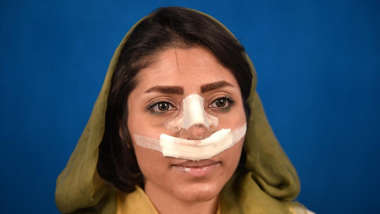 Eine Iranerin nach einer ästhetischen Nasen-Operation beim Hals-Nasen-Ohren-Spezialisten Dr. Hamit Riza Husnani (nicht zu sehen) in einer Klinik für plastische Chirurgie in Teheran.