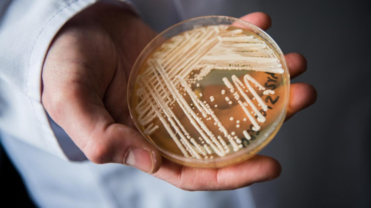 Der Leiter des Nationalen Referenzzentrums für invasive Pilzinfektionen, Oliver Kurzai, hält eine Petrischale mit dem Hefepilz Candida auris in den Händen. Der Leiter des Nationalen Referenzzentrums für invasive Pilzinfektionen, Oliver Kurzai, hält eine Petrischale mit dem Hefepilz Candida auris in den Händen.