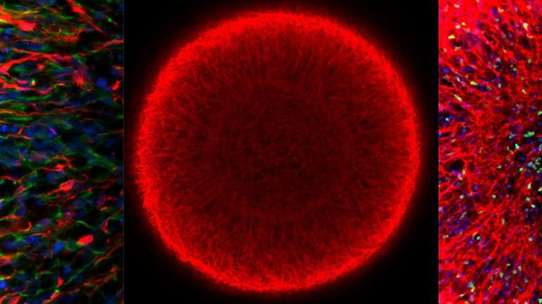 Ansichten eines Mittelhirn-Organoids im Mikroskop Ansichten eines Mittelhirn-Organoids im Mikroskop