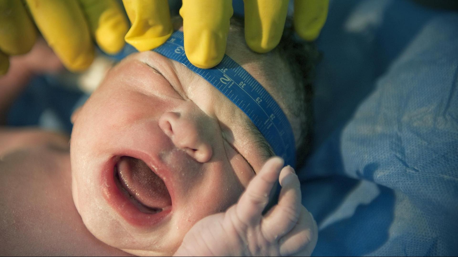 Eine Krankenschwester misst den Schädelumfang eines Neugeborenen. Eine Krankenschwester misst den Schädelumfang eines Neugeborenen.