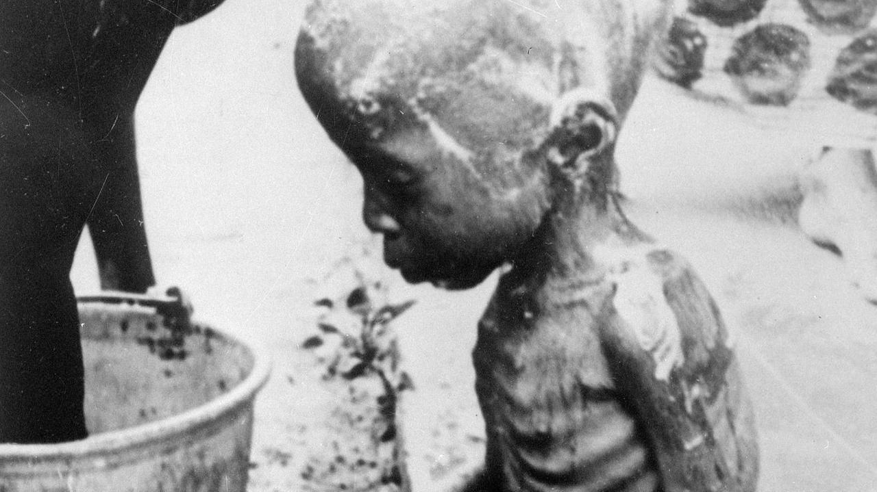 Ein Schwarz-Weiß-Foto, auf dem ein ausgehungertes afrikanisches Kleinkind zu sehen ist. Es sitzt auf einem Mauerstück und ist bis auf die Knochen abgemagert. Das Foto stammt von 1967, es wurde im damaligen Staat Biafra im Südosten Nigerias aufgenommen.