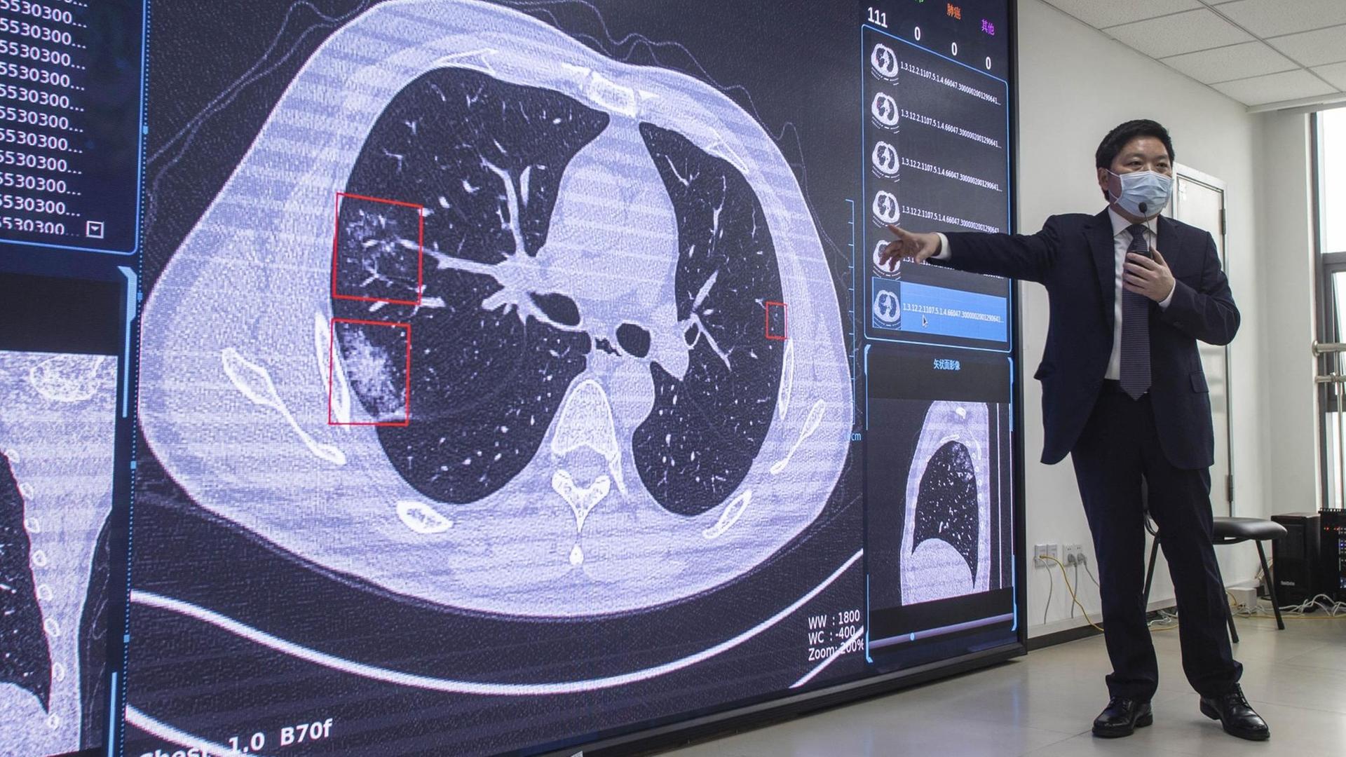 Ein Mann in Anzug und mit Maske zeigt auf einen an die Wand projizierten CT-Scan des Lungen/Brustbereichs. Ein Mann in Anzug und mit Maske zeigt auf einen an die Wand projizierten CT-Scan des Lungen/Brustbereichs.