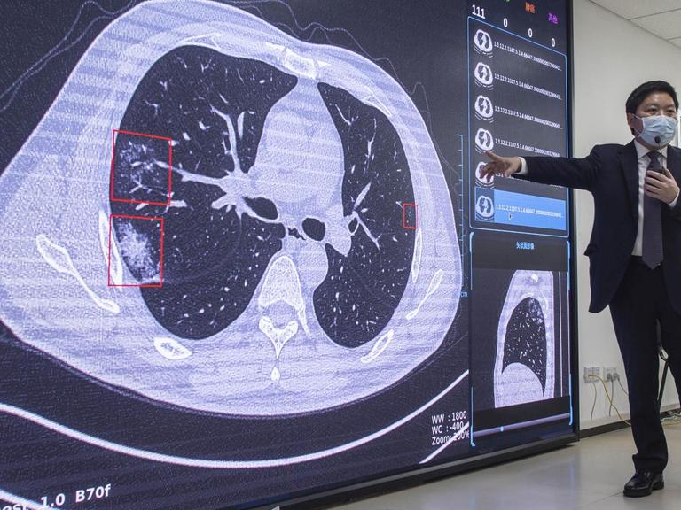Ein Mann in Anzug und mit Maske zeigt auf einen an die Wand projizierten CT-Scan des Lungen/Brustbereichs.