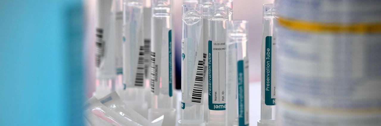Röhrchen mit den Abstrichen von Personen, die sich in einem Corona-Testzentrum einem PCR-Test unterzogen haben