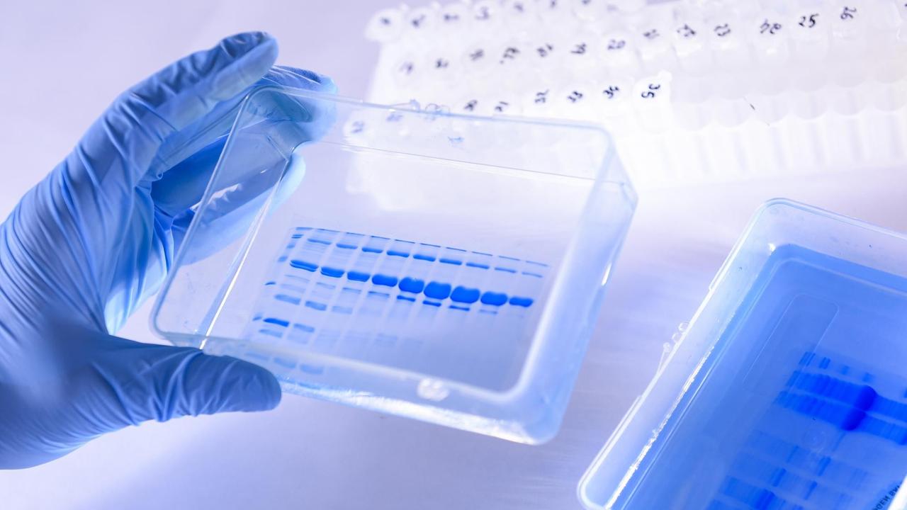 Beobachtung eines blauen Gels, das die Reinheit der im Labor produzierten Antigene bewertet.