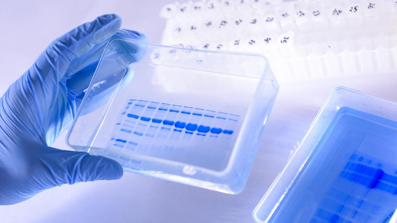 Beobachtung eines blauen Gels, das die Reinheit der im Labor produzierten Antigene bewertet. Beobachtung eines blauen Gels, das die Reinheit der im Labor produzierten Antigene bewertet.