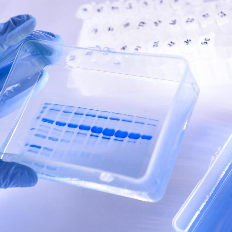 Beobachtung eines blauen Gels, das die Reinheit der im Labor produzierten Antigene bewertet.