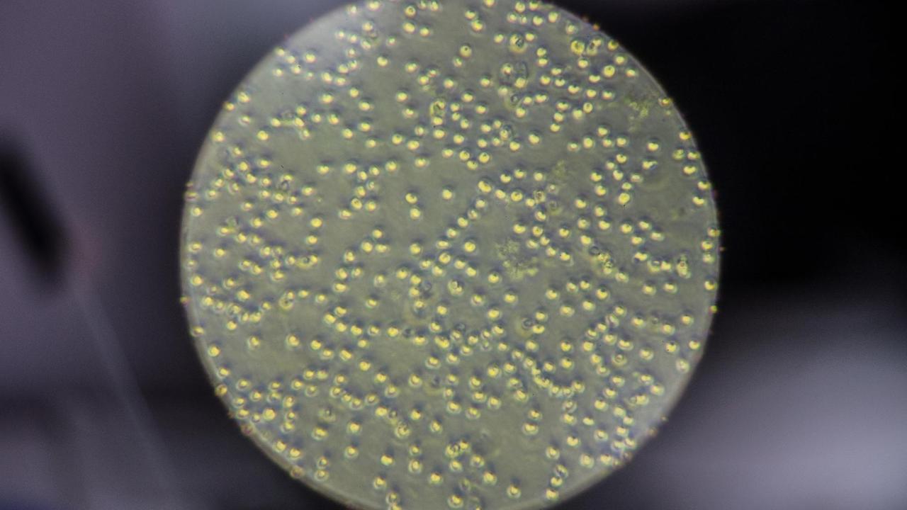 Blick durch ein Mikroskop zeigt Algen der Art "Chlorella Vulgaris" am EUREF-Campus in Berlin