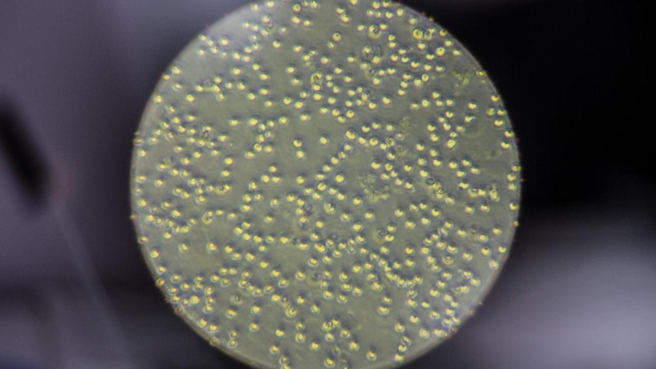 Blick durch ein Mikroskop zeigt Algen der Art "Chlorella Vulgaris" am EUREF-Campus in Berlin Blick durch ein Mikroskop zeigt Algen der Art "Chlorella Vulgaris" am EUREF-Campus in Berlin