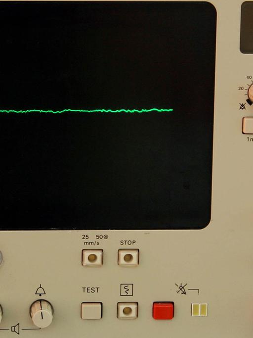 Ein EKG-Monitor zeigt eine Nulllinie an.