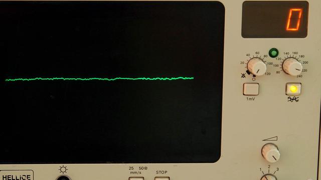 Ein EKG-Monitor zeigt eine Nulllinie an.