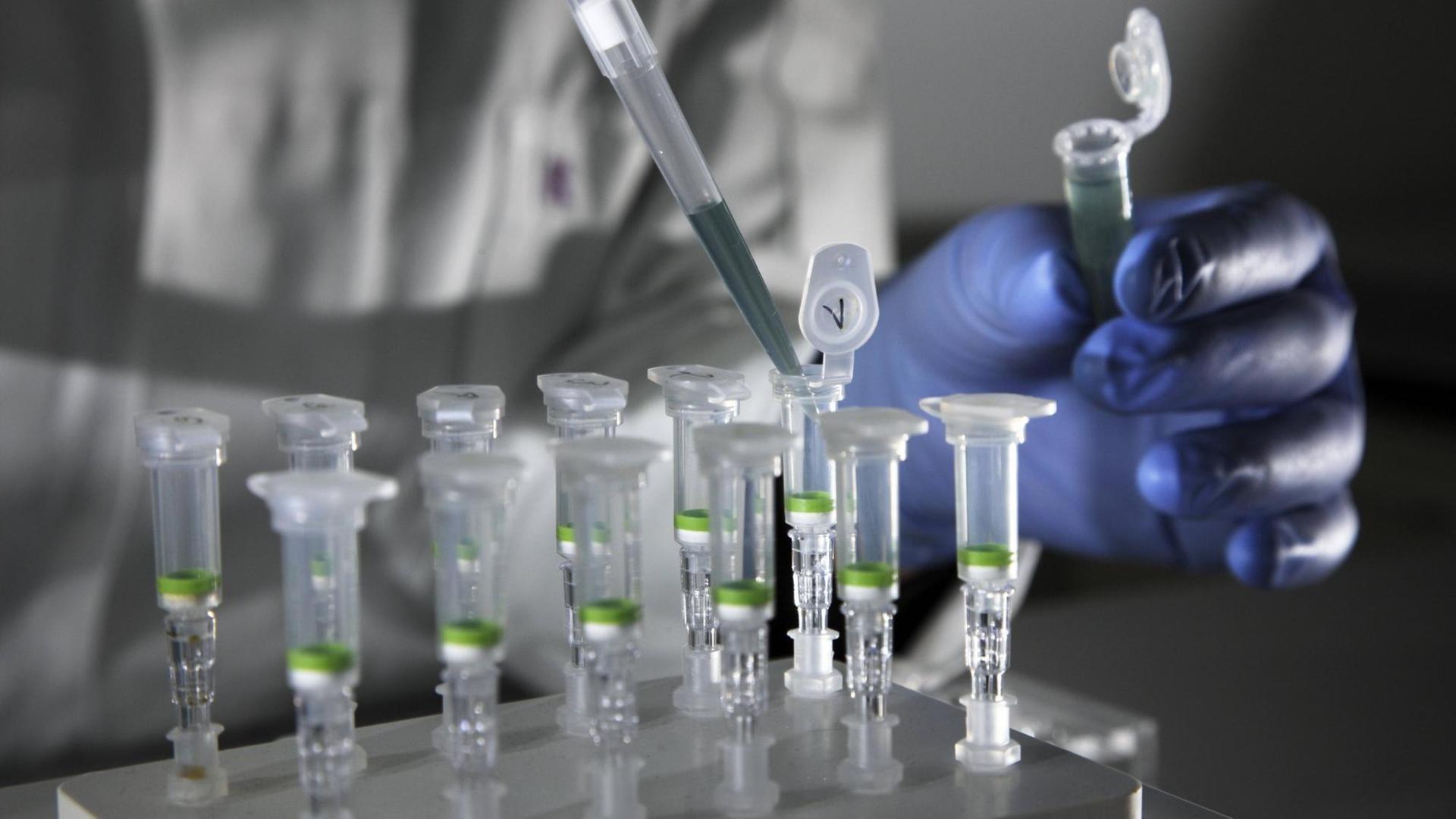 In einem Labor wird DNA analysiert. In einem Labor wird DNA analysiert.