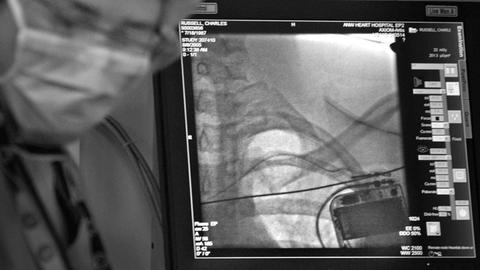 Auf einem Monitor ist ein Röntgenbild eines Medtronic-Defibrillators zu sehen, der einem Mann, Charlie Russell, vom Herzchirurgen Adrian Almquist implantiert wird, aufgenommen 2005 in Minneapolis
