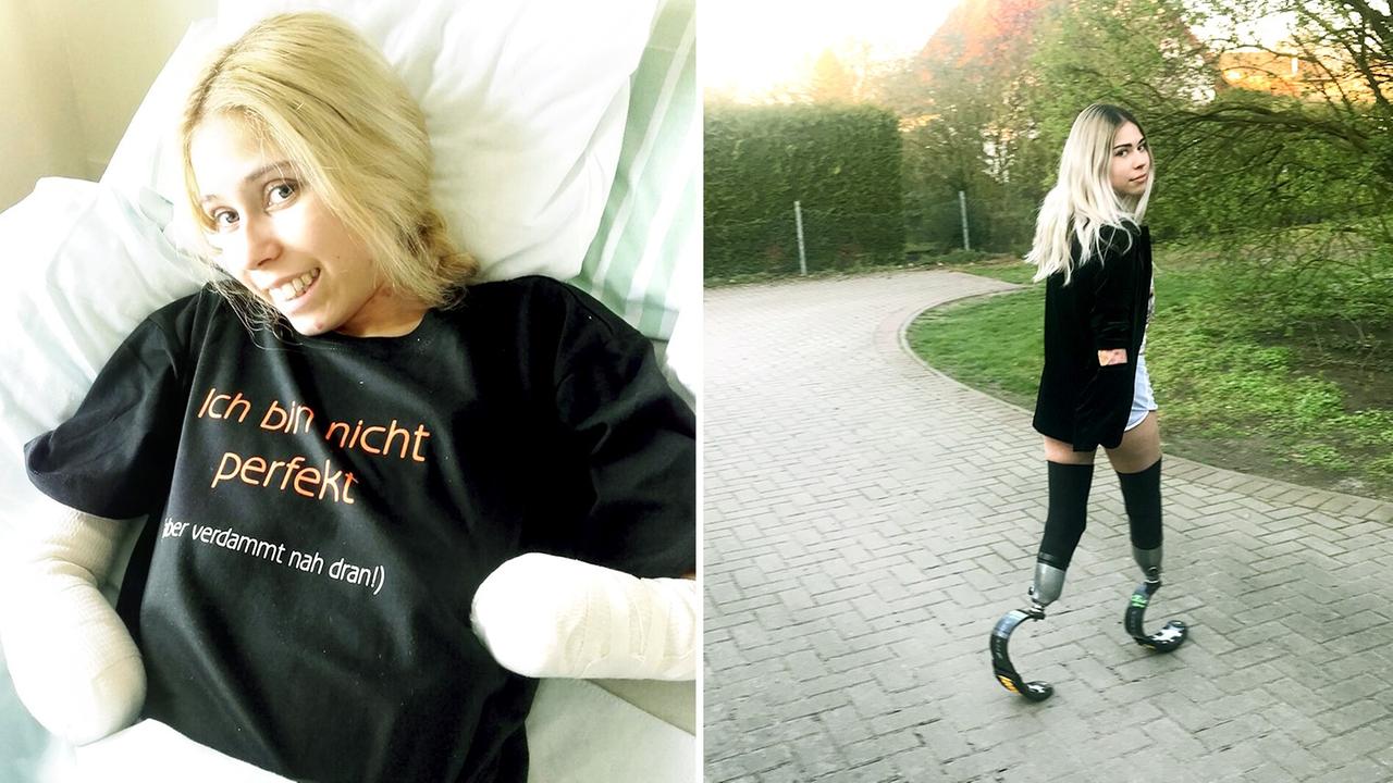Fotomontage: Alena Ehlers im Krankenhausbett - und mit Sportprothesen