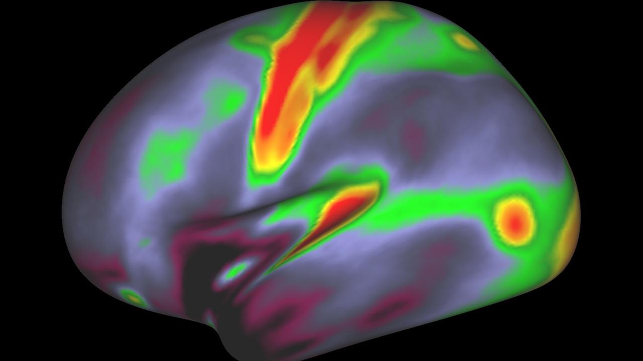Das menschliche Hirn in der Ansicht einer Magnetresonanztomografie Das menschliche Hirn in der Ansicht einer Magnetresonanztomografie
