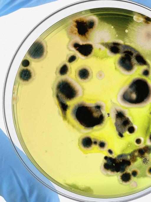 Steriler Handschuh mit Bakterien in einer Petrischale