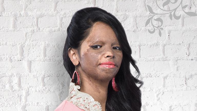 Laxmi Saa wurde im Alter von 15 Jahren von Männern mit Säure angegriffen, ihr Gesicht ist seitdem entstellt. Doch sie hat es geschafft, in einer Modekampagne aufzutreten. Laxmi Saa wurde im Alter von 15 Jahren von Männern mit Säure angegriffen, ihr Gesicht ist seitdem entstellt. Doch sie hat es geschafft, in einer Modekampagne aufzutreten.