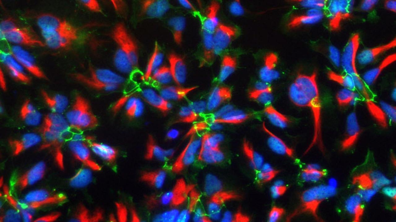 Aus humanen pluripotenten Stammzellen gewonnene humane neurale Stammzellen Immunfluoreszenzfärbung, bei der für neurale Stammzellen charakteristische Proteine mit Antikörpern farbig markiert wurden. (Nestin in rot, ZO1 in grün, Zellkerne in blau) Aus humanen pluripotenten Stammzellen gewonnene humane neurale Stammzellen Immunfluoreszenzfärbung, bei der für neurale Stammzellen charakteristische Proteine mit Antikörpern farbig markiert wurden. (Nestin in rot, ZO1 in grün, Zellkerne in blau)