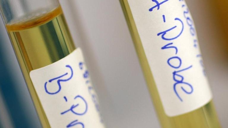Eine A-Probe und B-Probe beim Dopingtest. Eine A-Probe und B-Probe beim Dopingtest.