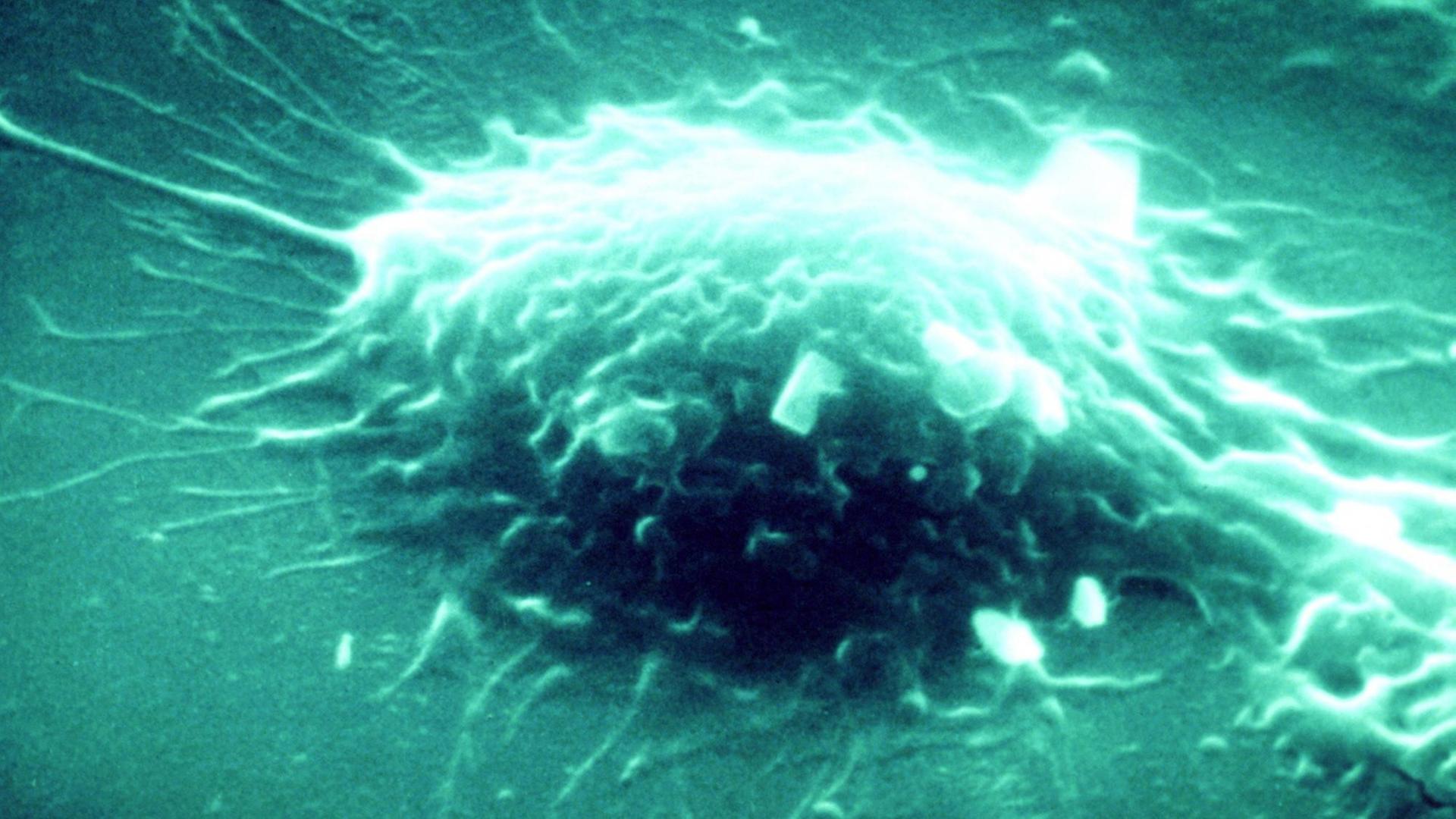 Rasterelektronenmikroskopische Aufnahme eines Makrophagen bei der Zerstörung eines Bakteriums. Rasterelektronenmikroskopische Aufnahme eines Makrophagen bei der Zerstörung eines Bakteriums.