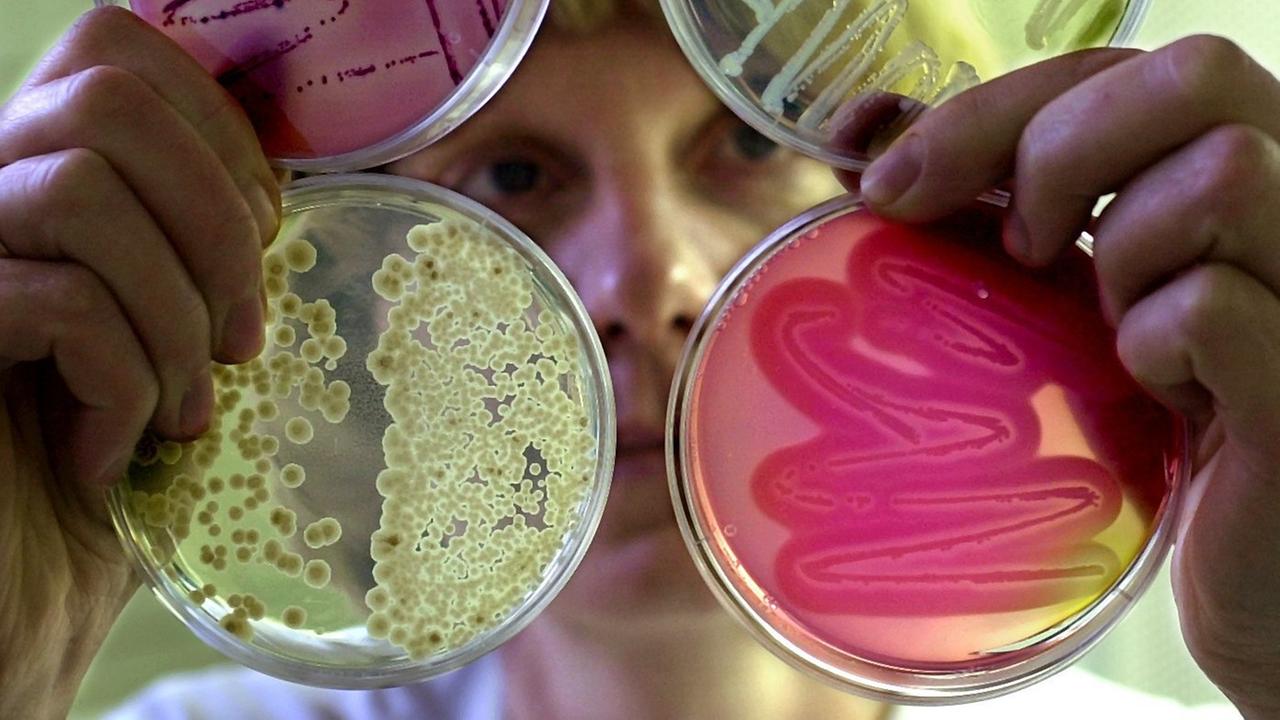 Mikroben vermehren sich im Labor auf speziellen Nährböden Mikroben vermehren sich im Labor auf speziellen Nährböden