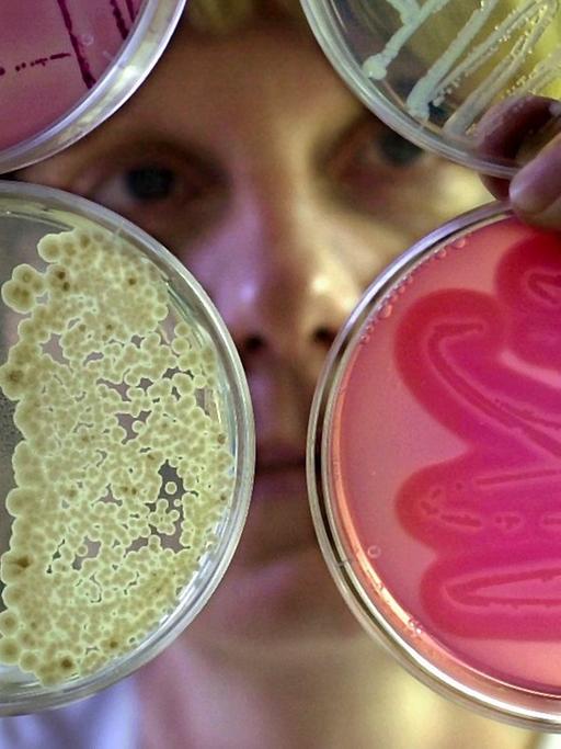 Mikroben vermehren sich im Labor auf speziellen Nährböden