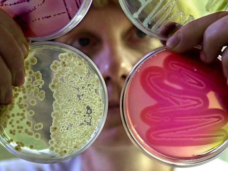 Mikroben vermehren sich im Labor auf speziellen Nährböden