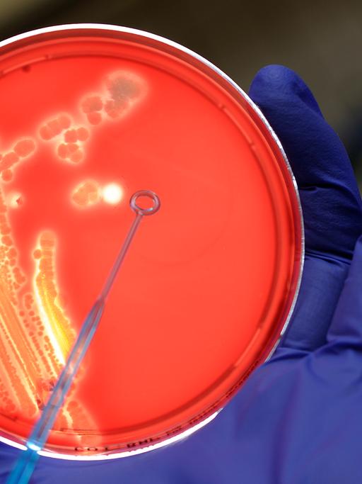 E.-coli-Bakterien in einer Petrischale