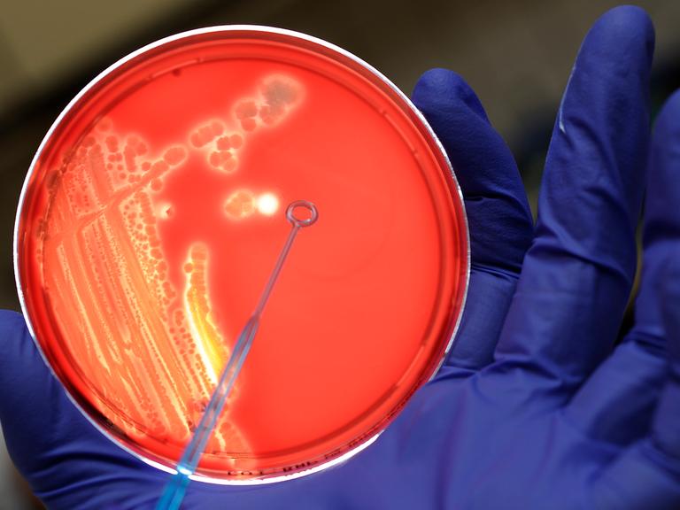 E.-coli-Bakterien in einer Petrischale