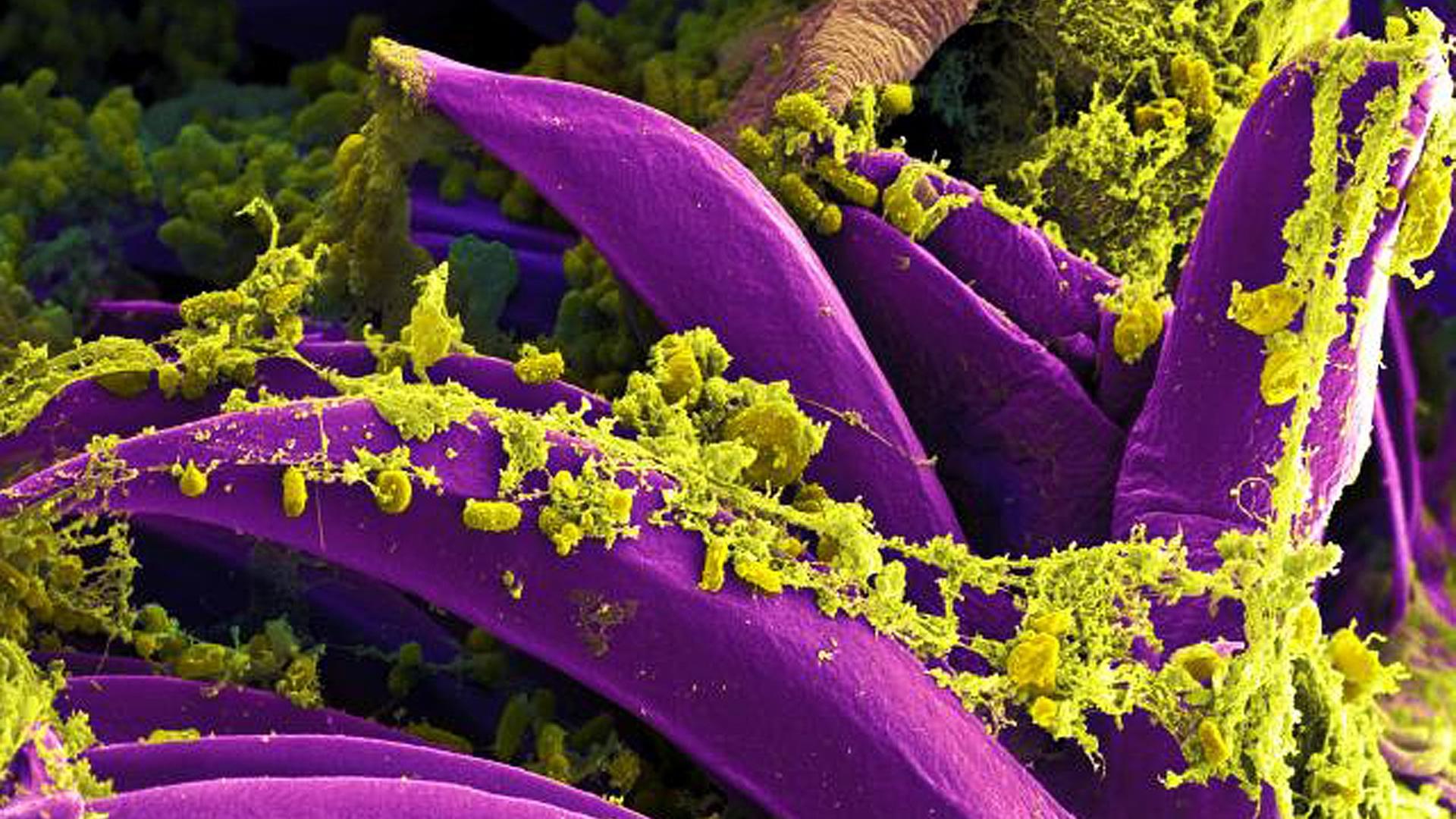 Produced by the National Institute of Allergy and Infectious Diseases (NIAID) in 2011, this digitally-colorized scanning electron micrograph (SEM) depicts a number of purple-colored Yersinia pestis bacteria that had gathered on the proventricular spines of a Xenopsylla cheopis flea. These spines line the interior of the proventriculus, a part of the flea_s digestive system. The Y. pestis bacterium is the pathogen that causes bubonic plague. Produced by the National Institute of Allergy and Infectious Diseases (NIAID) in 2011, this digitally-colorized scanning electron micrograph (SEM) depicts a number of purple-colored Yersinia pestis bacteria that had gathered on the proventricular spines of a Xenopsylla cheopis flea. These spines line the interior of the proventriculus, a part of the flea_s digestive system. The Y. pestis bacterium is the pathogen that causes bubonic plague.