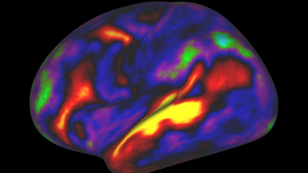 Eine Computersimulation des menschlichen Gehirns mit roten bis blauen Flächen. Je rötlicher ein Areal, desto mehr Myelin ("weiße Substanz") gibt es dort.